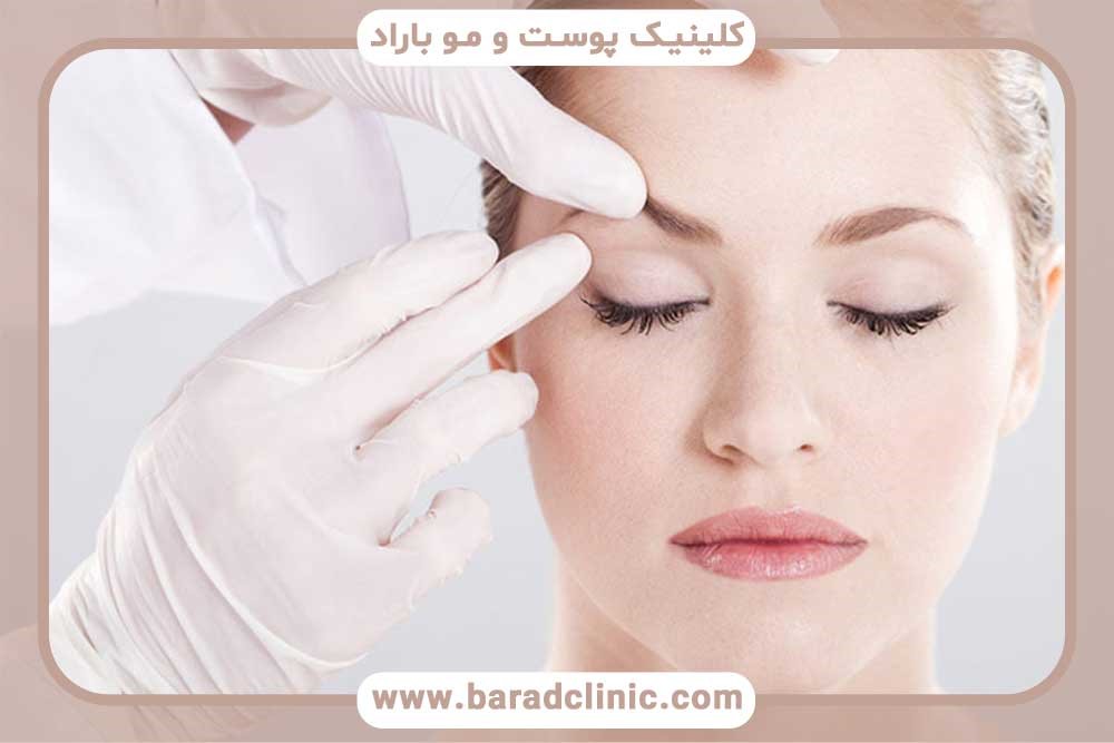 بلفاروپلاستی بدون درد و بخیه