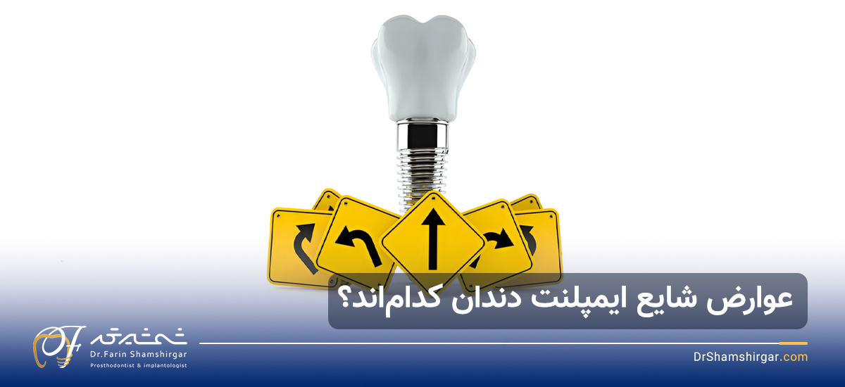 عوارض ایمپلنت دندان